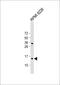 Zinc Ribbon Domain Containing 1 antibody, 61-307, ProSci, Western Blot image 
