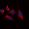 Cyclin Dependent Kinase 5 antibody, GTX32375, GeneTex, Immunofluorescence image 