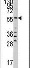 Seryl-TRNA Synthetase antibody, PA5-14980, Invitrogen Antibodies, Western Blot image 