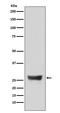 NADH:Ubiquinone Oxidoreductase Core Subunit S3 antibody, M05867, Boster Biological Technology, Western Blot image 