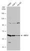 MEFV Innate Immuity Regulator, Pyrin antibody, GTX106272, GeneTex, Western Blot image 