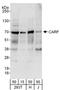 CaRF antibody, A303-862A, Bethyl Labs, Western Blot image 