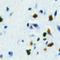 Forkhead box protein E3 antibody, LS-C368666, Lifespan Biosciences, Immunohistochemistry paraffin image 