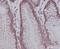 Yes Associated Protein 1 antibody, P00116, Boster Biological Technology, Immunohistochemistry paraffin image 