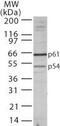 Transducin Beta Like 1 X-Linked Receptor 1 antibody, PA1-41271, Invitrogen Antibodies, Western Blot image 