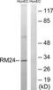 Mitochondrial Ribosomal Protein L24 antibody, TA315792, Origene, Western Blot image 