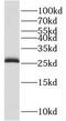 Tubulin Polymerization Promoting Protein antibody, FNab08898, FineTest, Western Blot image 