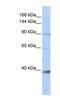 NCK Associated Protein 1 Like antibody, NBP1-79230, Novus Biologicals, Western Blot image 