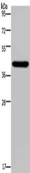 NPHS2 Stomatin Family Member, Podocin antibody, CSB-PA579527, Cusabio, Western Blot image 