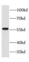 LUC7L3 antibody, FNab01992, FineTest, Western Blot image 