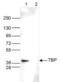 TATA-Box Binding Protein antibody, NBP2-59208, Novus Biologicals, Western Blot image 