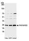 Platelet Activating Factor Acetylhydrolase 1b Catalytic Subunit 3 antibody, A305-527A, Bethyl Labs, Western Blot image 