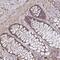 Zinc Finger Protein 805 antibody, NBP2-32403, Novus Biologicals, Immunohistochemistry paraffin image 