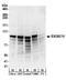 RRP6 antibody, A303-987A, Bethyl Labs, Western Blot image 