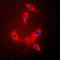 Protein Phosphatase 2 Scaffold Subunit Abeta antibody, GTX55165, GeneTex, Immunocytochemistry image 