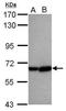 Cytochrome P450 Family 2 Subfamily C Member 8 antibody, PA5-29796, Invitrogen Antibodies, Western Blot image 
