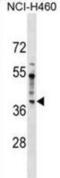 Serologically Defined Colon Cancer Antigen 8 antibody, abx029545, Abbexa, Western Blot image 