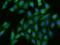 Interferon Alpha And Beta Receptor Subunit 1 antibody, 200100-T02, Sino Biological, Immunohistochemistry frozen image 