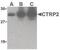 C1q And TNF Related 2 antibody, PA5-20197, Invitrogen Antibodies, Western Blot image 