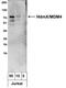 MDM4 antibody, NB100-556, Novus Biologicals, Western Blot image 