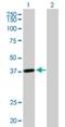 Leucine Rich Repeat Containing 39 antibody, H00127495-B01P, Novus Biologicals, Western Blot image 
