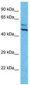 Aurora Kinase A antibody, TA335339, Origene, Western Blot image 