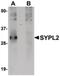 Synaptophysin-like protein 2 antibody, PA5-20776, Invitrogen Antibodies, Western Blot image 