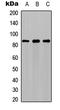 Pfk-m antibody, LS-C358834, Lifespan Biosciences, Western Blot image 
