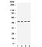 Coagulation Factor II Thrombin Receptor antibody, R32032, NSJ Bioreagents, Western Blot image 