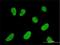 Nuclear Factor Of Activated T Cells 2 Interacting Protein antibody, H00084901-M01, Novus Biologicals, Immunofluorescence image 