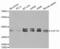 Eukaryotic Translation Elongation Factor 1 Delta antibody, abx001951, Abbexa, Western Blot image 