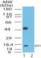 Acid Phosphatase antibody, PA1-41704, Invitrogen Antibodies, Western Blot image 