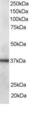 PDZ and LIM domain protein 1 antibody, NBP1-51917, Novus Biologicals, Western Blot image 