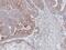 Mitogen-Activated Protein Kinase 9 antibody, NBP1-30905, Novus Biologicals, Immunohistochemistry paraffin image 