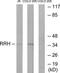 Retinal Pigment Epithelium-Derived Rhodopsin Homolog antibody, TA315094, Origene, Western Blot image 