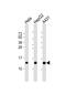 NADH dehydrogenase [ubiquinone] 1 beta subcomplex subunit 3 antibody, PA5-49506, Invitrogen Antibodies, Western Blot image 