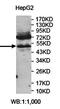 Zinc Finger Protein 562 antibody, orb78188, Biorbyt, Western Blot image 