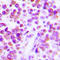 Tumor Necrosis Factor antibody, LS-C352973, Lifespan Biosciences, Immunohistochemistry paraffin image 