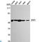 Protein Phosphatase 5 Catalytic Subunit antibody, LS-C813088, Lifespan Biosciences, Western Blot image 