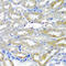 Cryptochrome Circadian Regulator 1 antibody, LS-C348980, Lifespan Biosciences, Immunohistochemistry paraffin image 