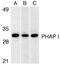 ANP32A antibody, GTX25991, GeneTex, Western Blot image 
