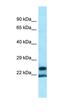 YrdC N6-Threonylcarbamoyltransferase Domain Containing antibody, orb326548, Biorbyt, Western Blot image 