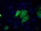 Sterol O-Acyltransferase 2 antibody, LS-C115248, Lifespan Biosciences, Immunofluorescence image 