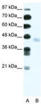 FEZ Family Zinc Finger 2 antibody, TA331874, Origene, Western Blot image 