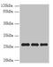 Peroxisomal Biogenesis Factor 11 Beta antibody, A60234-100, Epigentek, Western Blot image 