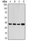 Replication factor C subunit 5 antibody, orb382007, Biorbyt, Western Blot image 