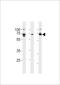 Protein Kinase AMP-Activated Non-Catalytic Subunit Gamma 3 antibody, LS-C162149, Lifespan Biosciences, Western Blot image 