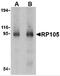 CD180 antigen antibody, 3841, ProSci, Western Blot image 