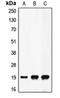 Coagulation Factor II, Thrombin antibody, orb213912, Biorbyt, Western Blot image 