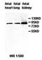 Arf-GAP with GTPase, ANK repeat and PH domain-containing protein 3 antibody, orb77509, Biorbyt, Western Blot image 